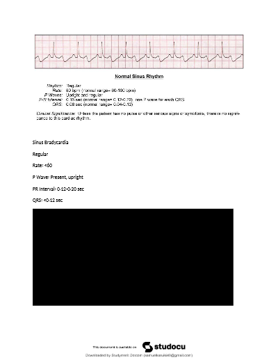 Relias Dysrhythmia Basic A Test – 2025/2026 – Complete Questions and Correct Answers